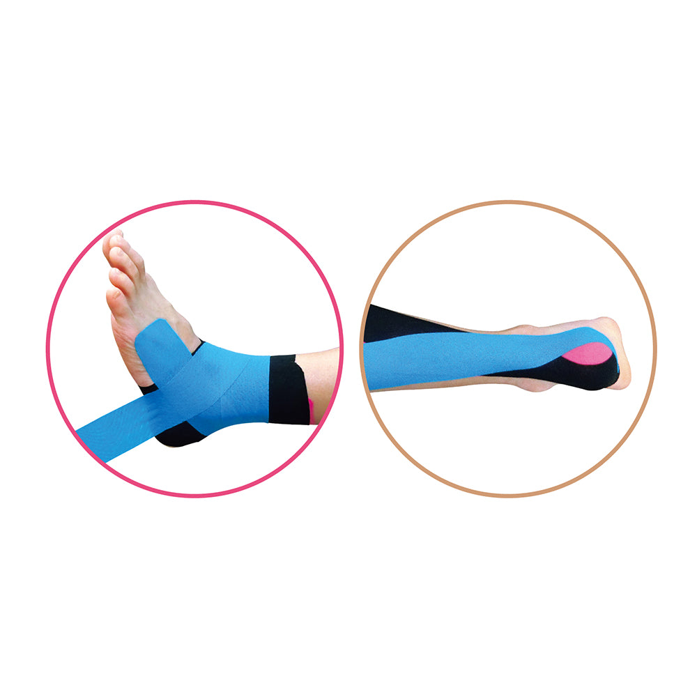 キネシオロジーテープ