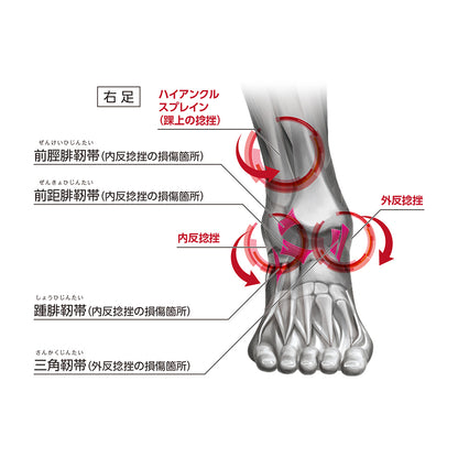 アジャスタブル アンクルスタビライザー
