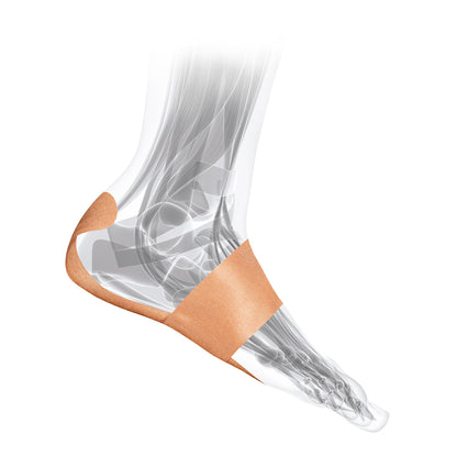 PF Tape (Plantar Fascia Support Tape)